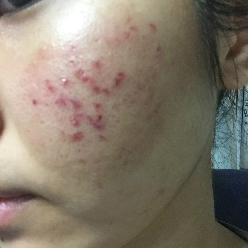 KakaoTalk_20170210_203344356.jpg
